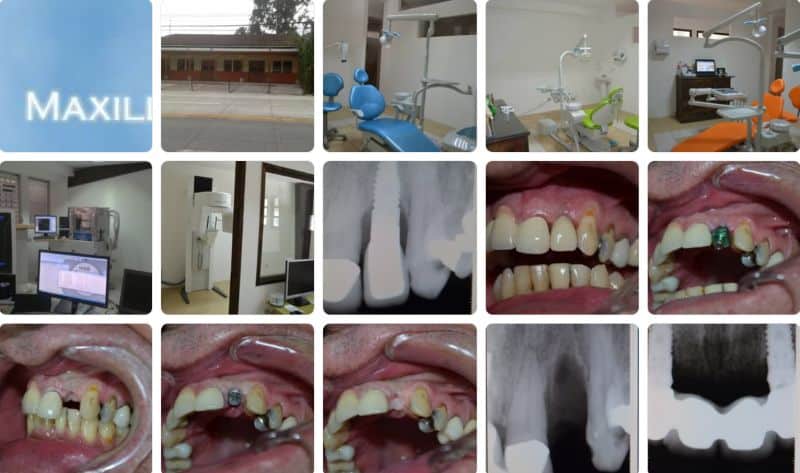 Maxillofacial Centre Antigua Facebook Feed